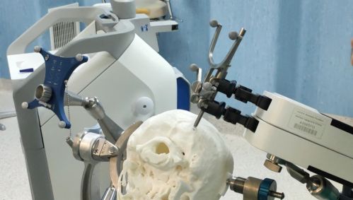 Dal Cnr-Ic innovazione in neurochirurgia pediatrica con stampati 3D e robotica